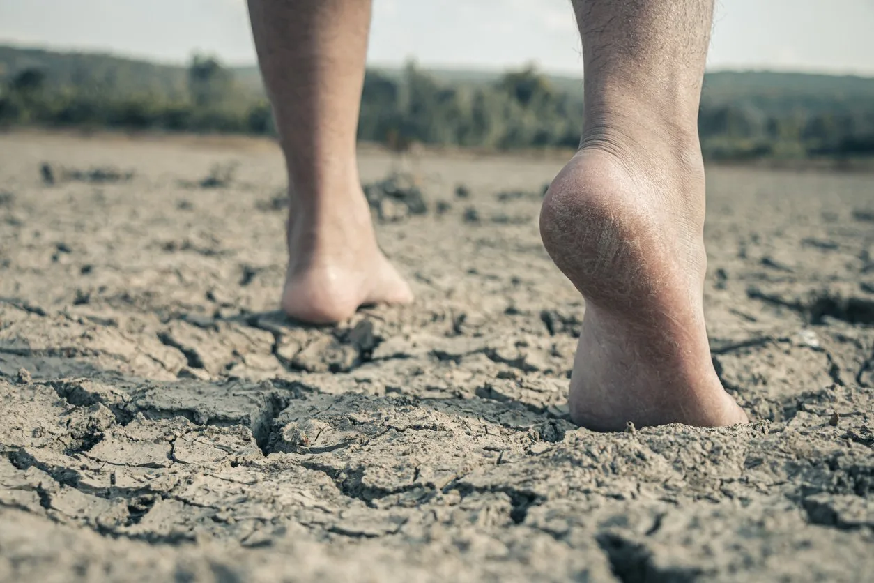 Feet Over Parched Land